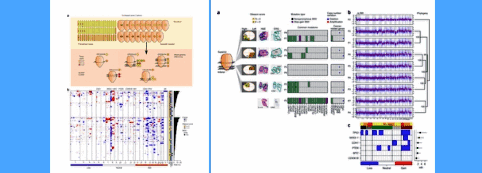 The landscape of Gleason score 7 prostate cancer. Clinical relevance of intratumoral heterogeneity. Nature Genetics.