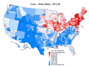 Map of colon cancer, USA